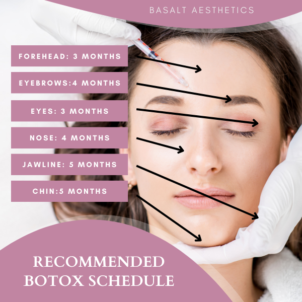 Recommended Botox Schedule Infographic